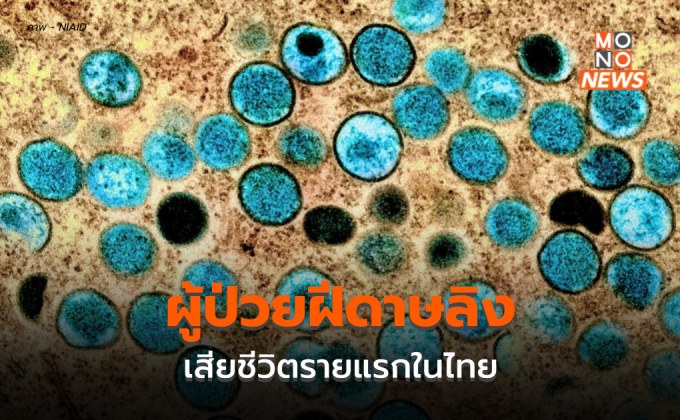 พบผู้ป่วยฝีดาษลิงในไทย เสียชีวิตรายแรก