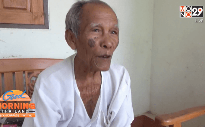 หมอกควันกระทบผู้ป่วยแม่เมาะ