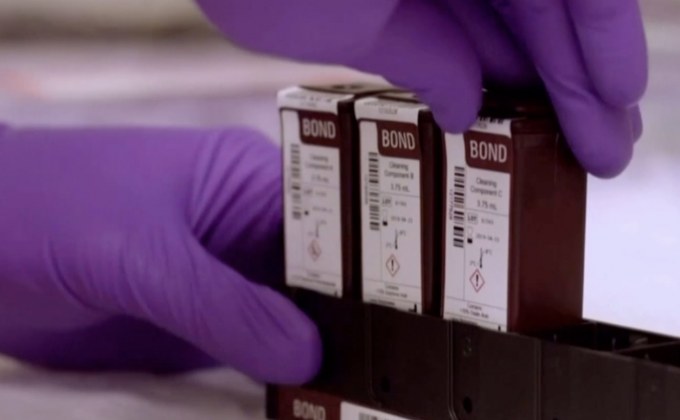 สถานการณ์ไวรัสโควิด-19 ในต่างประเทศ 28-07-63