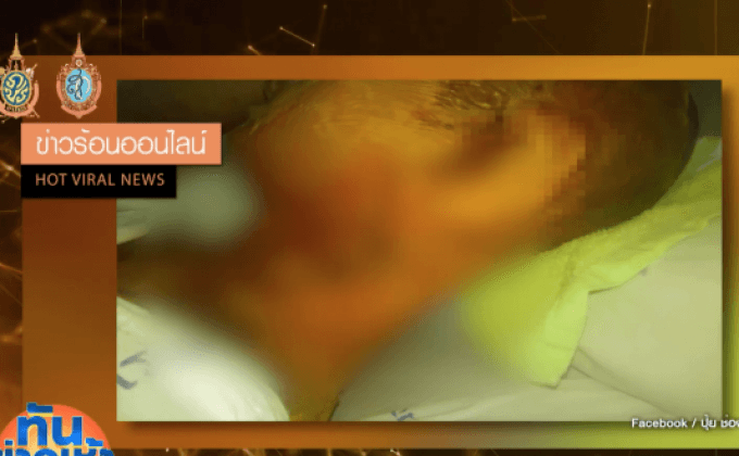พ่อวอนช่วยลูก ถูกสายตร.เมา เอาน้ำมันเดือดราด
