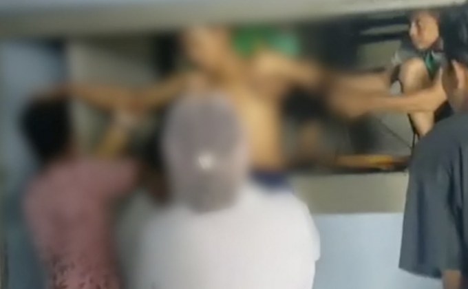 หนุ่มส่งของเผลอวางมือบนขอบปูนถูกลิฟท์หนีบกระดูกมือแตก