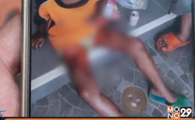 อนาถเด็กหญิงถูกทำร้ายเป็นแผลเหวอะ