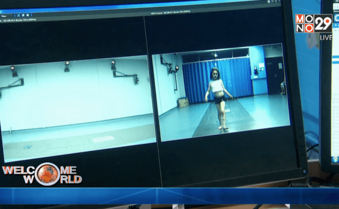 เทคโนโลยี Motion Capture กับวงการแพทย์