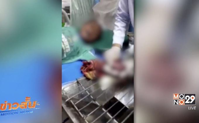 ประทัดระเบิดใส่มือเด็ก 3 คน จ.ยะลา