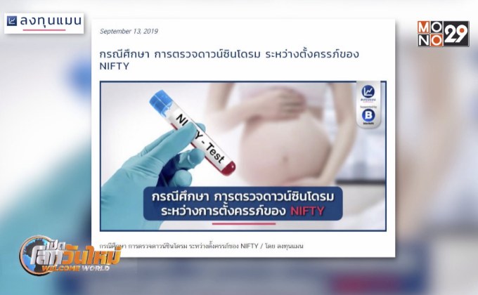 ตรวจดาวน์ซินโดรมระหว่างตั้งครรภ์ของ NIFTY