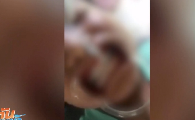 สั่งสอบคลิปเด็กชายรับจัดฟันเถื่อน เสี่ยงอันตราย-ผิดกม.