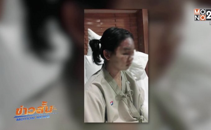 เอาผิดบริษัททำสารเคมีระเบิดถูกนศ.ฝึกงานสาหัส