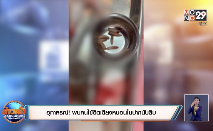 อุทาหรณ์ ! พบคนไข้ติดเตียงหนอนในปากนับสิบ