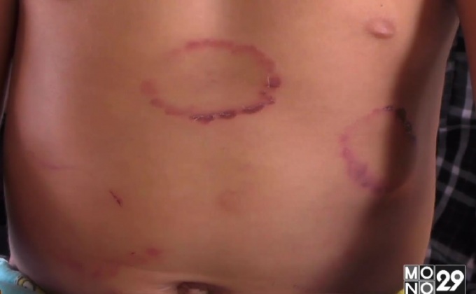 พ่อเลี้ยงโหด ทารุณลูกเลี้ยง 2 ขวบ