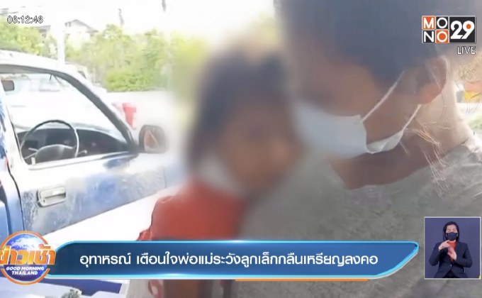 อุทาหรณ์ เตือนใจพ่อแม่ระวังลูกเล็กกลืนเหรียญลงคอ