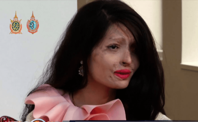 หญิงอินเดียเหยื่อสาดน้ำกรดร่วมเดินแบบที่นิวยอร์ก