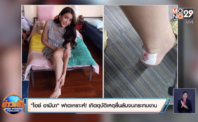 “ไอซ์ อามีนา” ฟาดเคราะห์! เกิดอุบัติเหตุลื่นล้มจนกระทบงาน