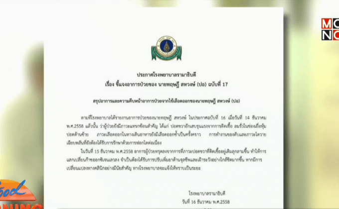 “ปอ ทฤษฎี”อาการทรุดหนักปอดขวาติดเชื้อลุกลาม