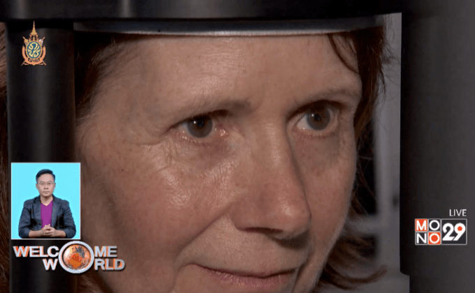 การศึกษาดวงตากับการวินิจฉัยโรคอัลไซเมอร์