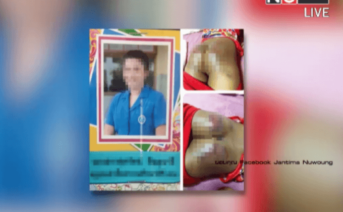 ผู้ปกครองแจ้งความอาจารย์ตีนักเรียนเกินกว่าเหตุ