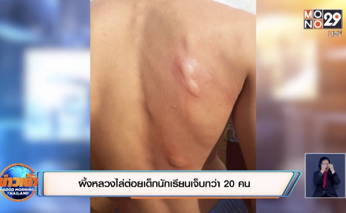 ผึ้งหลวงไล่ต่อยเด็กนักเรียนเจ็บกว่า 20 คน