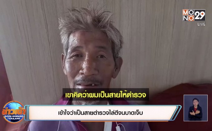 เข้าใจว่าเป็นสายตำรวจไล่ตีจนบาดเจ็บ