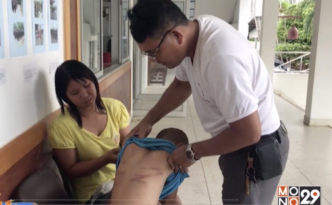 ตั้งกรรมการสอบครูลงโทษเด็ก จ.สุรินทร์