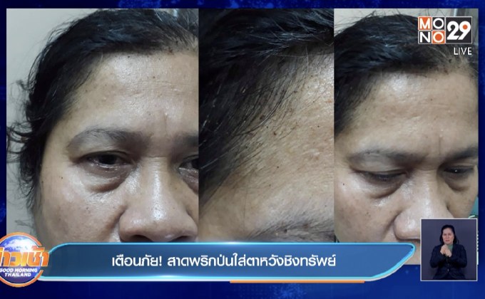 เตือนภัย! สาดพริกป่นใส่ตาหวังชิงทรัพย์