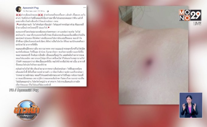 เตือนเที่ยวป่าระวังโรค “สครับไทฟัส”