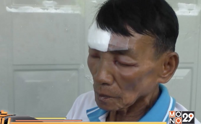 บริษัทเก้าอี้นวดไฟฟ้าจ่ายเงินเยียวยาผู้บาดเจ็บ 2 หมื่น