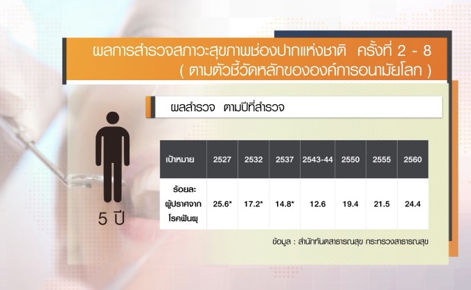 ผลสำรวจสภาวะช่องปาก คนไทยมีแนวโน้มดีขึ้น