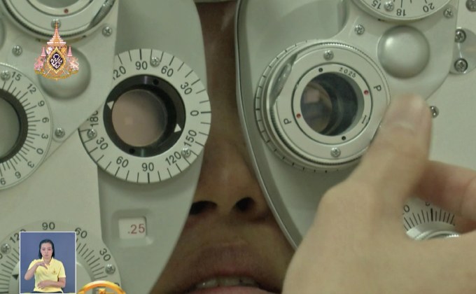 ​สปส.ให้สิทธิ์ผู้ประกันตน ผ่าตัดเปลี่ยนอวัยวะกระจกตาฟรี