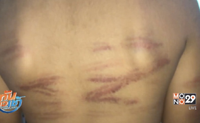 ยาย โพสต์เฟซบุ๊ก ครูใจร้ายใช้ไม้เรียวกระหน่ำตีหลาน