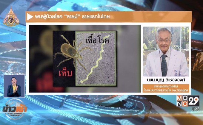 พบผู้ป่วยโรค “ลายม์” รายแรกในไทย