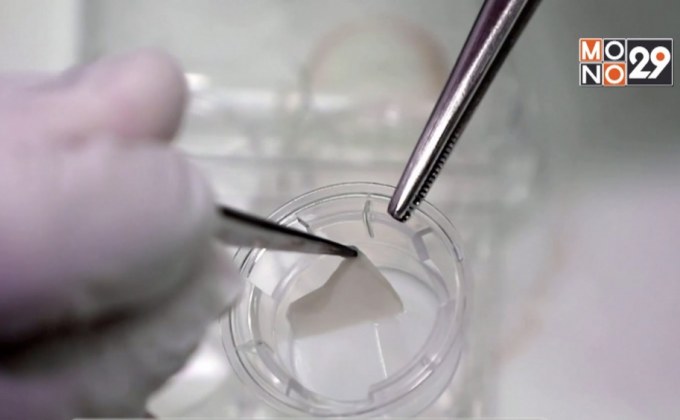 นักวิทย์สิงคโปร์พัฒนาผิวหนังเทียม