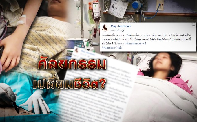 ศัลยกรรมเปลี่ยนชีวิต? 16-07-61