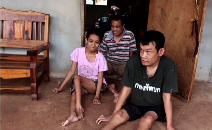 สุดเวทนา 3 พี่น้อง พิการป่วยโรคโปลิโอ