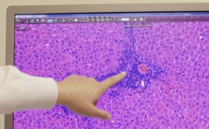 “โมเดอร์น่า” โชว์ความสำเร็จทดสอบวัคซีนระยะแรก