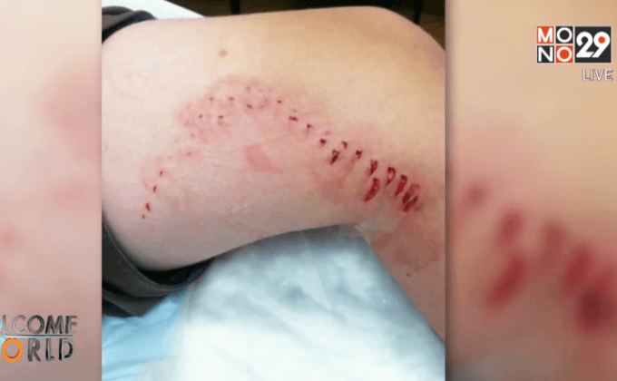 ชาวอเมริกันหวั่นฉลามบุกรุกหาดฝั่งตะวันออก