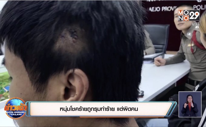 หนุ่มโชคร้ายถูกรุมทำร้าย แต่ผิดคน