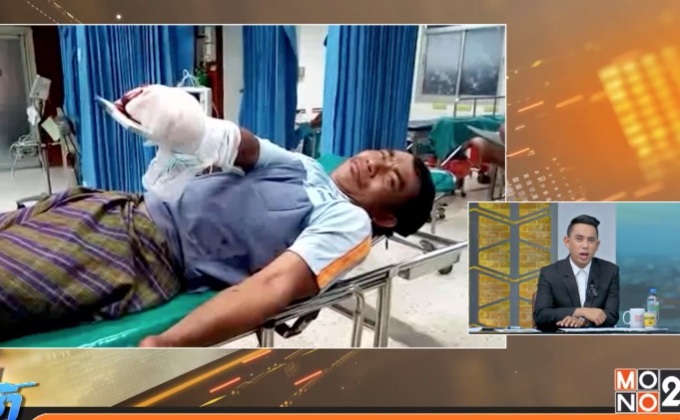 สยอง! พลุระเบิดใส่คนจุดชนวนเจ็บสาหัส