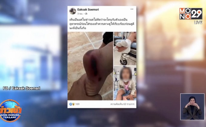 พ่อรับรีบร้อนเกิน ไม่ได้เคาะรองเท้าทำกิ้งกืดกัดเท้าลูกสาว 7 ขวบ