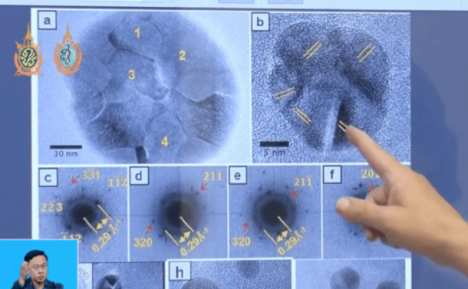 พบอนุภาคแม่เหล็กในสมองมนุษย์