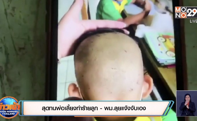 สุดทนพ่อเลี้ยงทำร้ายลูก – พม.ลุยแจ้งจับเอง