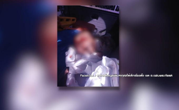 สุนัขจรจัดกัดทารกวัย 19 วัน อาการสาหัส