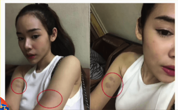 “น้องฟ้า บาร์บี้” แฉถูก “โตส-อัครัช” ทำร้าย