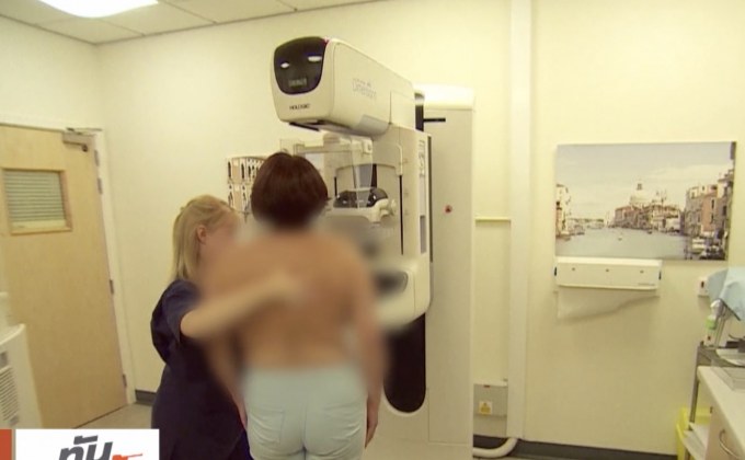 อังกฤษขอโทษเหตุขัดข้องในโครงการมะเร็งเต้านม