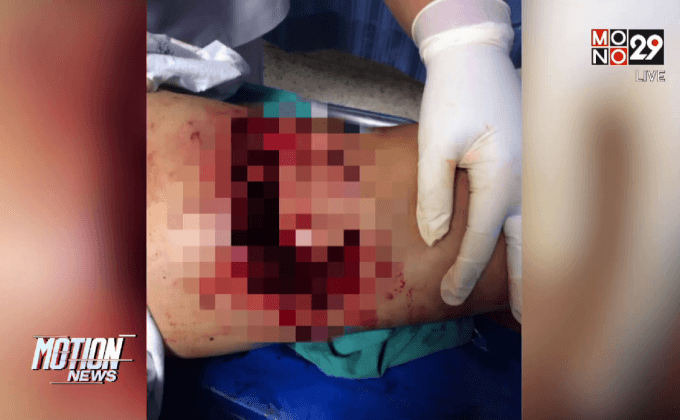 หมีทำร้ายชาวบ้าน จ.บุรีรัมย์