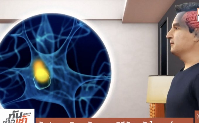 นักประสาทวิทยาอังกฤษหาวิธีรักษาอัลไซเมอร์