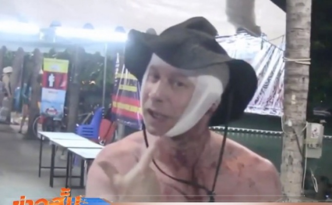 นักท่องเที่ยวถูกทำร้ายร่างกายที่พัทยา