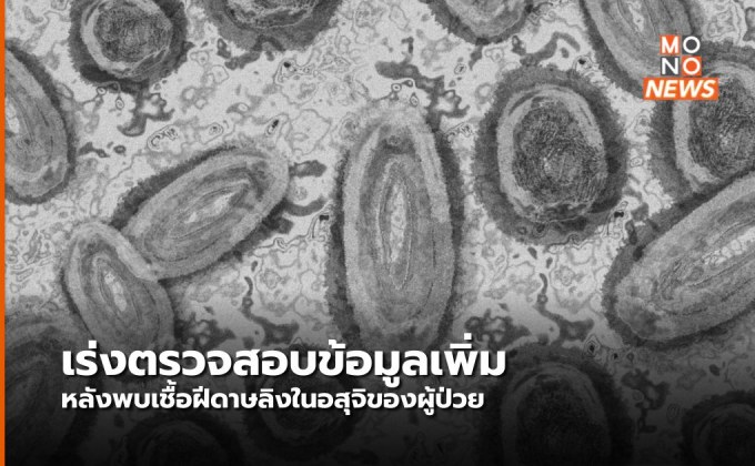 WHO ตรวจสอบรายงานพบเชื้อฝีดาษลิงในอสุจิ