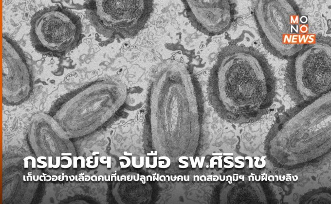 กรมวิทย์ฯ จับมือ รพ.ศิริราช เก็บตัวอย่างเลือดคนที่เคยปลูกฝีดาษคน ทดสอบภูมิฯ กับฝีดาษลิง