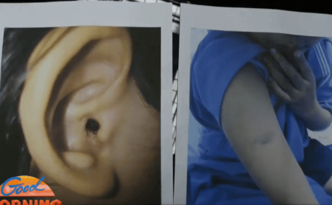 สอบพ่อเลี้ยงโหด ทำร้ายร่างกาย จุดไฟแช็คเผาลิ้นลูกเลี้ยง 