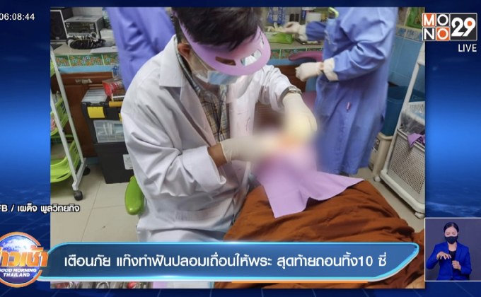 เตือนภัย แก๊งทำฟันปลอมเถื่อนให้พระ สุดท้ายถอนทิ้ง10 ซี่