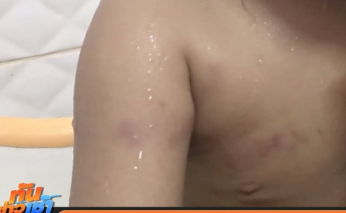 แม่เด็ก 2 ขวบยืนยันเอาเรื่องครูผู้ช่วย-โรงเรียนให้ถึงที่สุด